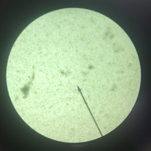 British wildlife pond water under microscope